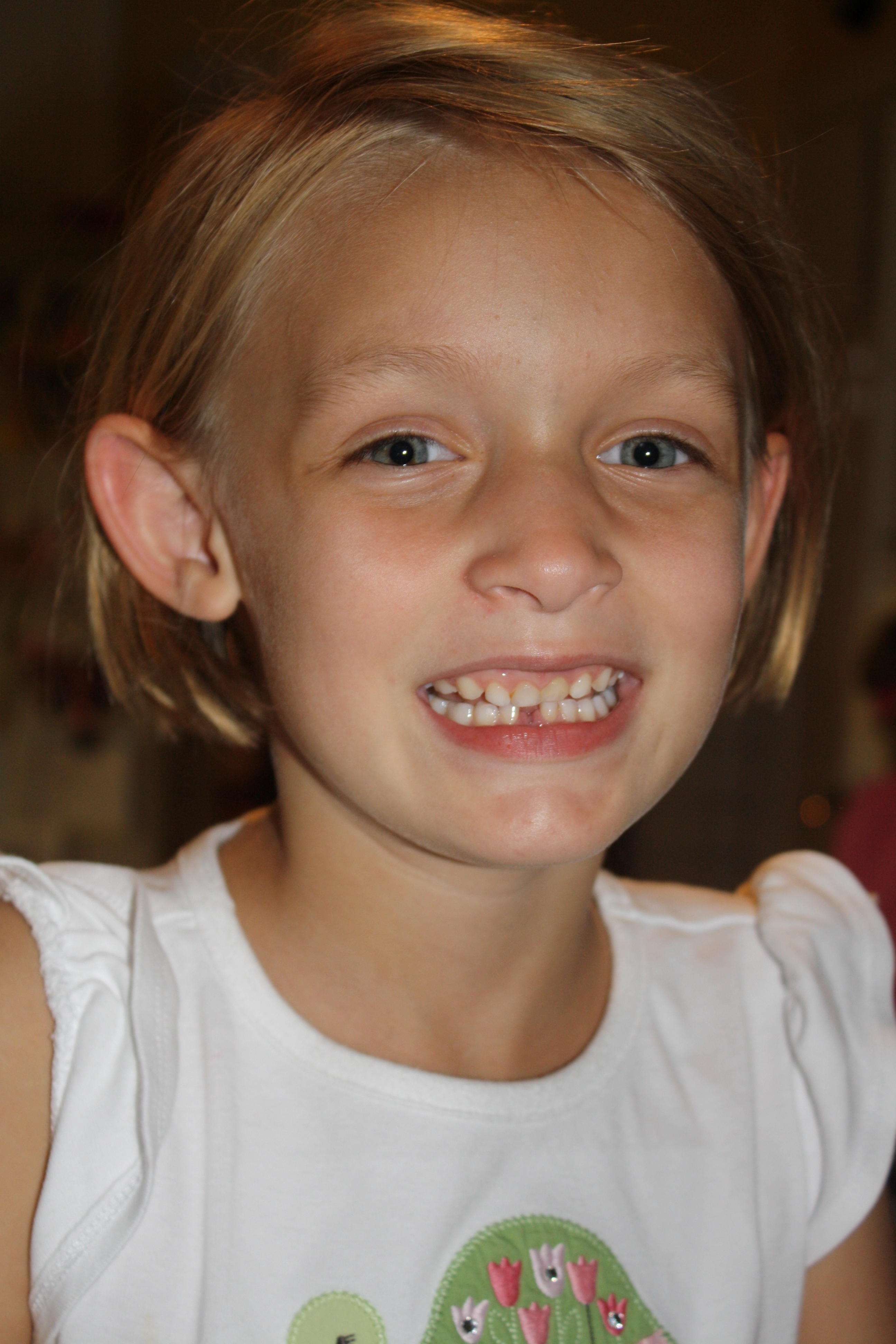 2010_09_19 Cate 1st lost tooth.jpg